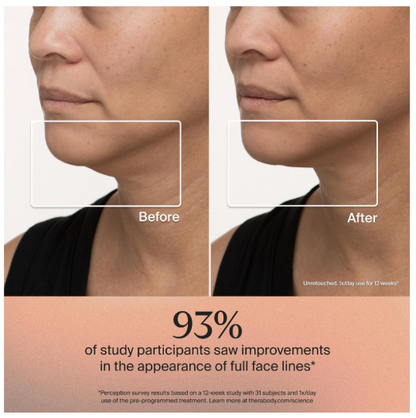 TheraFace LED Light Therapy Mask – Advanced Facial Skincare & Wellness Device